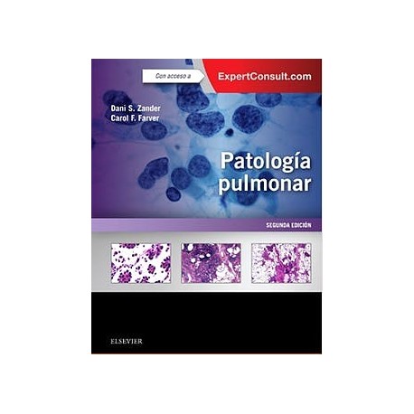 PATOLOGIA PULMONAR + EXPERTCONSULT