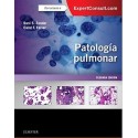 PATOLOGIA PULMONAR + EXPERTCONSULT