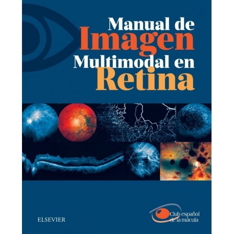 MANUAL DE IMAGEN MULTIMODAL EN RETINA