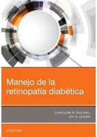 MANEJO DE LA RETINOPATIA DIABETICA