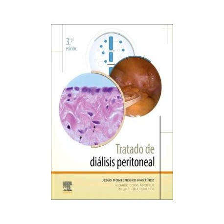 TRATADO DE DIALISIS PERITONEAL