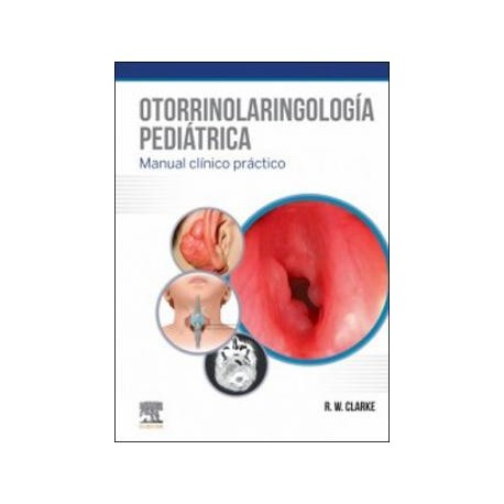 OTORRINOLARINGOLOGIA PEDIATRICA. MANUAL CLINICO PRACTICO