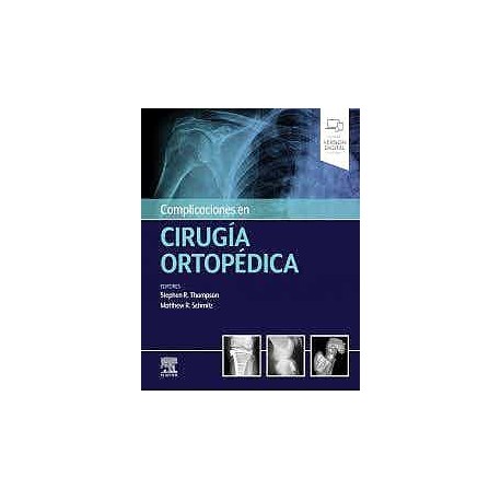 COMPLICACIONES EN CIRUGIA ORTOPEDICA