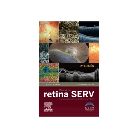 MANUAL DE RETINA SERV