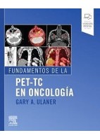 FUNDAMENTOS DE LA PET-TC EN ONCOLOGIA
