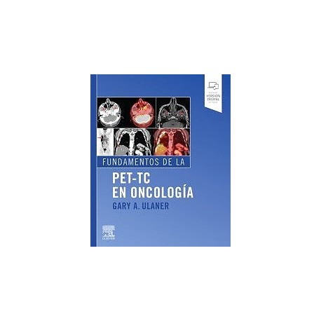 FUNDAMENTOS DE LA PET-TC EN ONCOLOGIA