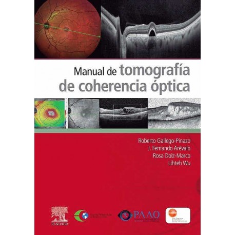 MANUAL DE TOMOGRAFIA DE COHERENDIA OPTICA