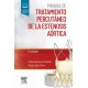 MANUAL DE TRATAMIENTO PERCUTANEO DE LA ESTENOSIS AORTICA (INCLUYE CONTENIDO DIGITAL)