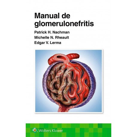 MANUAL DE GLOMERULONEFRITIS