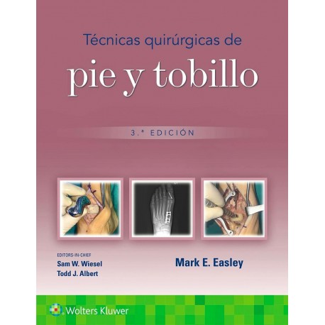 TECNICAS QUIRURGICAS DE PIE Y TOBILLO