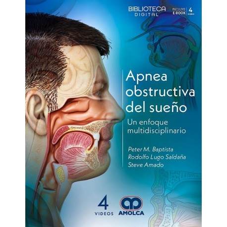 APNEA OBSTRUCTIVA DEL SUEÑO. UN ENFOQUE MULTIDISCIPLINARIO (INCLUYE EBOOK + 4 VIDEOS)