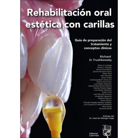REHABILITACION ORAL ESTETICA CON CARILLAS