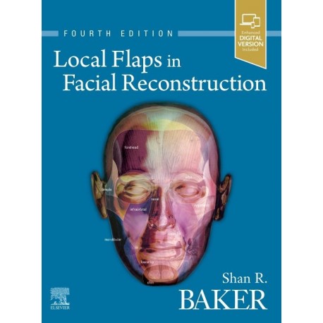 LOCAL FLAPS IN FACIAL RECONSTRUCTION (DIGITAL VERSION INCLUDED)