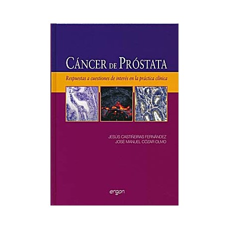 CANCER DE PROSTATA