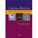 CANCER DE PROSTATA