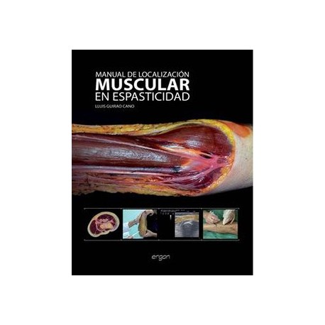 MANUAL DE LOCALIZACION MUSCULAR EN ESPASTICIDAD