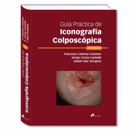 GUIA PRACTICA DE ICONOGRAFIA COLPOSCOPICA