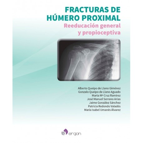 FRACTURAS DE HUMERO PROXIMAL. REEDUCACION GENERAL Y PROPIOCEPTIVA