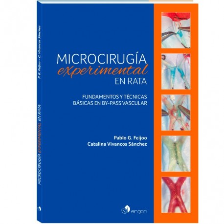 MICROCIRUGIA EXPERIMENTAL EN RATA. FUNDAMENTOS Y TECNICAS BASICAS EN BY-PASS VASCULAR