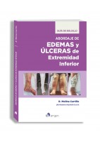 ABORDAJE DE EDEMAS Y ULCERAS DE EXTREMIDAD INFERIOR. GUIA DE BOLSILLO