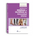 ABORDAJE DE EDEMAS Y ULCERAS DE EXTREMIDAD INFERIOR. GUIA DE BOLSILLO
