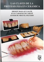 LAS CLAVES DE LA PROTESIS FIJA EN CERAMICA