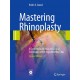 MASTERING RHINOPLASTY