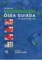 20 AÑOS DE REGENERACION OSEA GUIADA EN IMPLANTOLOGIA ORAL