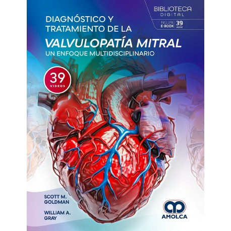 DIAGNOSTICO Y TRATAMIENTO DE LA VALVULOPATIA MITRAL