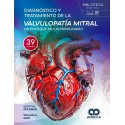 DIAGNOSTICO Y TRATAMIENTO DE LA VALVULOPATIA MITRAL