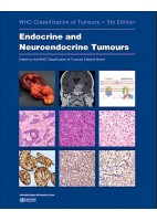 WHO CLASSIFICATION OF TUMOURS: ENDOCRINE AND NEUROENDOCRINE TUMOURS