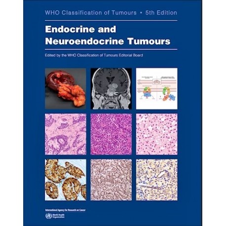 WHO CLASSIFICATION OF TUMOURS: ENDOCRINE AND NEUROENDOCRINE TUMOURS