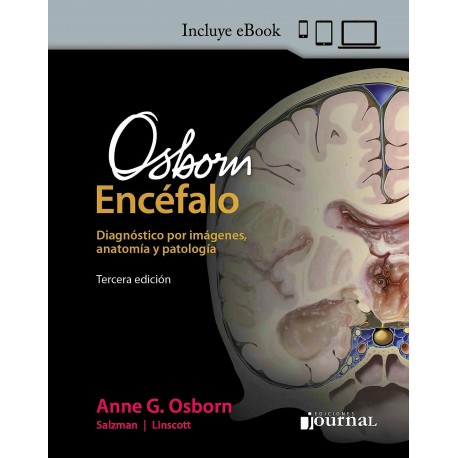 OSBORN ENCEFALO. DIAGNOSTICO POR LA IMAGEN. ANATOMIA Y PATOLOGIA