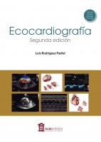 ECOCARDIOGRAFIA