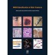 WHO CLASSIFICATION OF SKIN TUMOURS