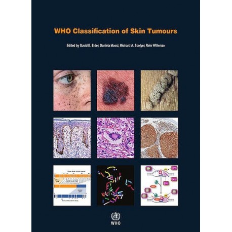 WHO CLASSIFICATION OF SKIN TUMOURS