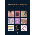 WHO CLASSIFICATION OF SKIN TUMOURS