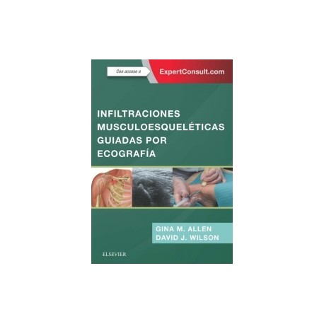 INFILTRACIONES MUSCULOESQUELETICAS GUIADAS POR ECOGRAFIA