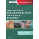 INFILTRACIONES MUSCULOESQUELETICAS GUIADAS POR ECOGRAFIA