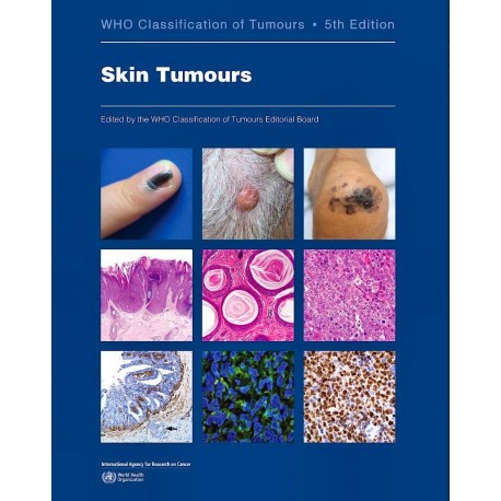 WHO CLASSIFICATION OF TUMOURS: SKIN TUMOURS