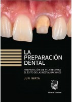 LA PREPARACION DENTAL. PREPARACION DE DIENTES PARA EL EXITO DE LAS RESTAURACIONES