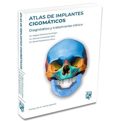 ATLAS DE IMPLANTES CIGOMATICOS. DIAGNOSTICO Y TRATAMIENTO CLINICO