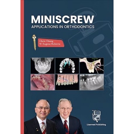 MINISCREW APPLICATIONS IN ORTHODONTICS