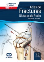 ATLAS DE FRACTURAS DISTALES DEL RADIO