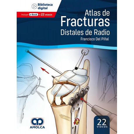 ATLAS DE FRACTURAS DISTALES DEL RADIO
