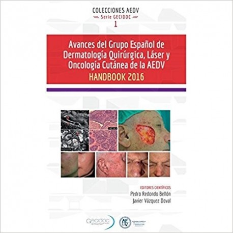 AVANCES DEL GRUPO ESPAÑOL DE DERMATOLOGIA QUIRURGICA, LASER Y ONCOLOGIA CUTANEA DE LA AEDV. HANDBOOK 2016