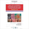 AVANCES DEL GRUPO ESPAÑOL DE DERMATOLOGIA QUIRURGICA, LASER Y ONCOLOGIA CUTANEA DE LA AEDV. HANDBOOK 2016
