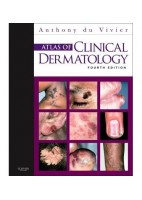 ATLAS OF CLINICAL DERMATOLOGY