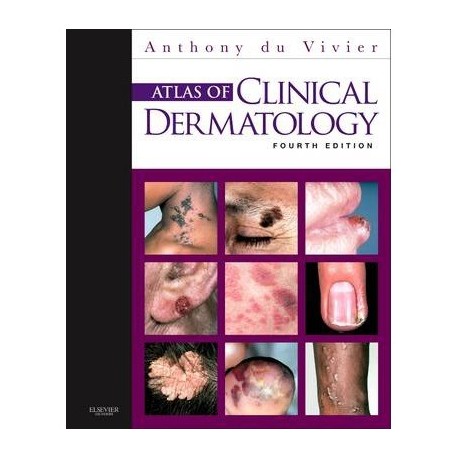 ATLAS OF CLINICAL DERMATOLOGY