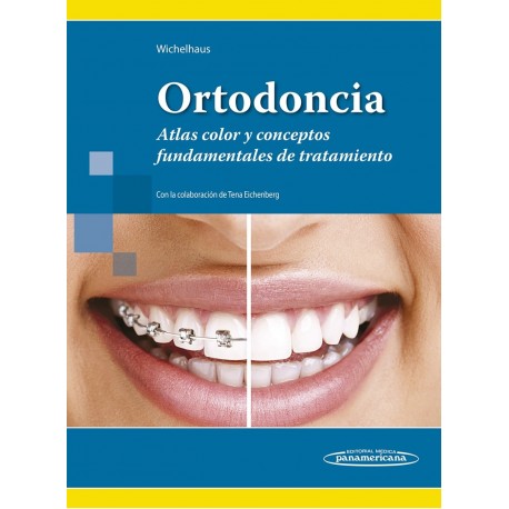 ORTODONCIA. ATLAS COLOR Y CONCEPTOS FUNDAMENTALES DE TRATAMIENTO
